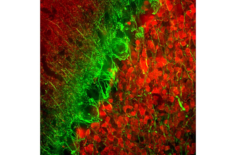Immunofluorescence - Anti-alpha Internexin Antibody [1D2] (A85447) - Antibodies.com