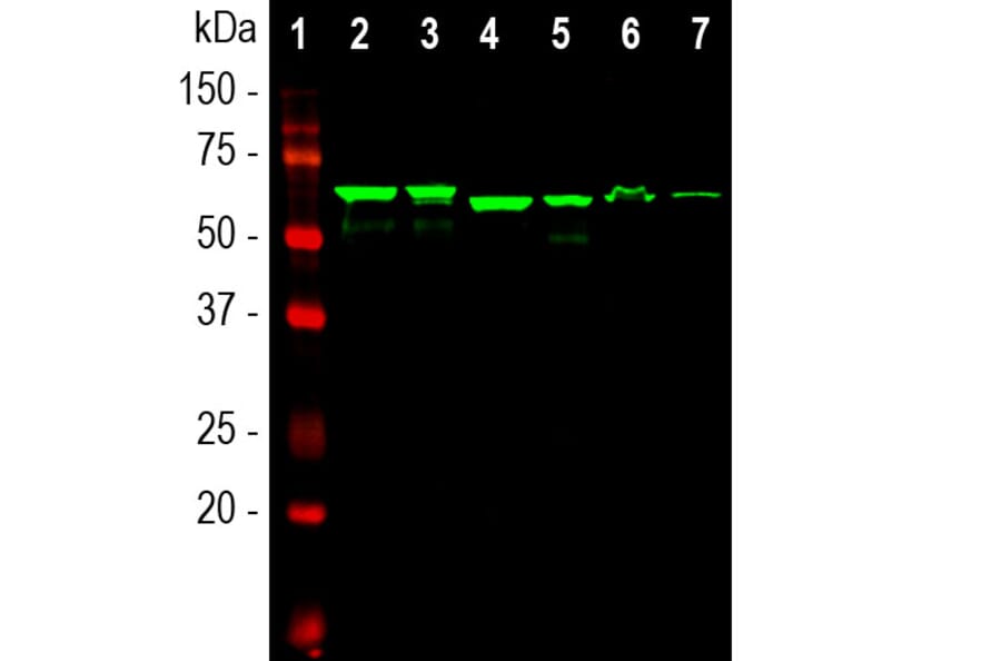 Western Blot - Anti-alpha Internexin Antibody [1D2] (A85447) - Antibodies.com