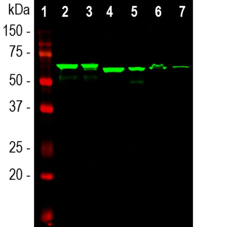 Western Blot - Anti-alpha Internexin Antibody [1D2] (A85447) - Antibodies.com