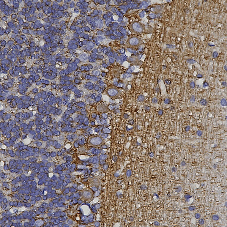 Immunohistochemistry - Anti-alpha Internexin Antibody [1D2] (A85447) - Antibodies.com