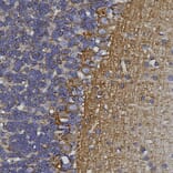 Immunohistochemistry - Anti-alpha Internexin Antibody [1D2] (A85447) - Antibodies.com