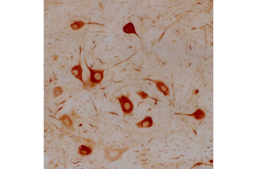 Immunohistochemistry - Anti-alpha Internexin Antibody [2E3] (A85448) - Antibodies.com