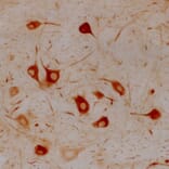 Immunohistochemistry - Anti-alpha Internexin Antibody [2E3] (A85448) - Antibodies.com