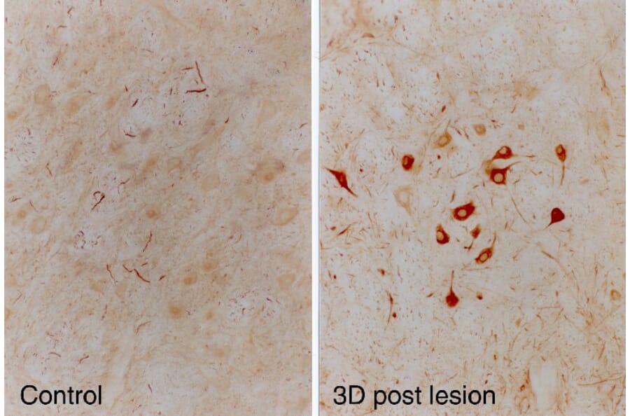 Immunohistochemistry - Anti-alpha Internexin Antibody [2E3] (A85448) - Antibodies.com