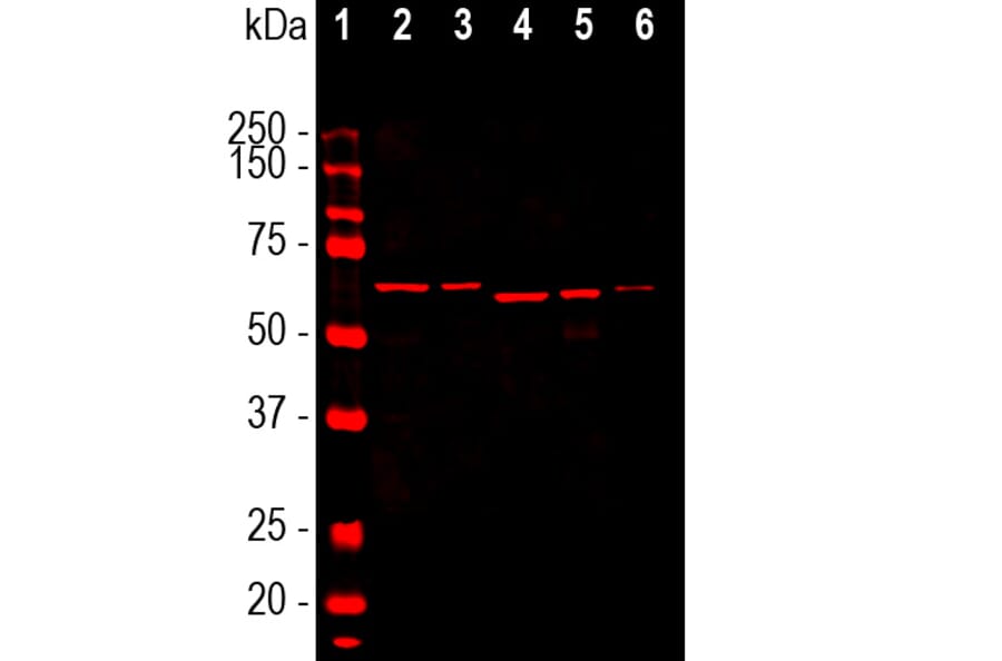 Western Blot - Anti-alpha Internexin Antibody [2E3] (A85448) - Antibodies.com