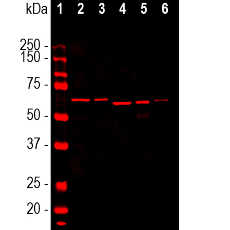 Western Blot - Anti-alpha Internexin Antibody [2E3] (A85448) - Antibodies.com
