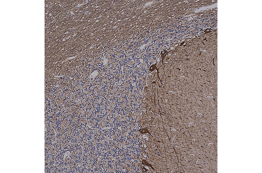 Immunohistochemistry - Anti-alpha Internexin Antibody [2E3] (A85448) - Antibodies.com