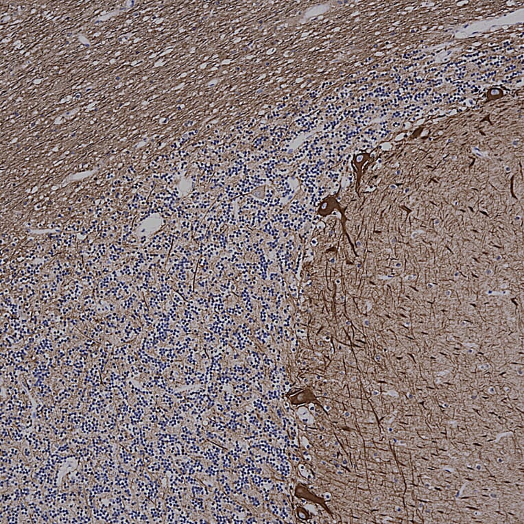 Immunohistochemistry - Anti-alpha Internexin Antibody [2E3] (A85448) - Antibodies.com