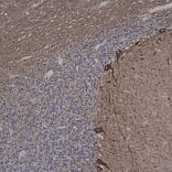 Immunohistochemistry - Anti-alpha Internexin Antibody [2E3] (A85448) - Antibodies.com