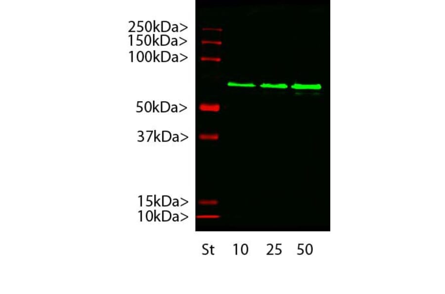 Western Blot - Anti-alpha Internexin Antibody [2E3] (A85448) - Antibodies.com
