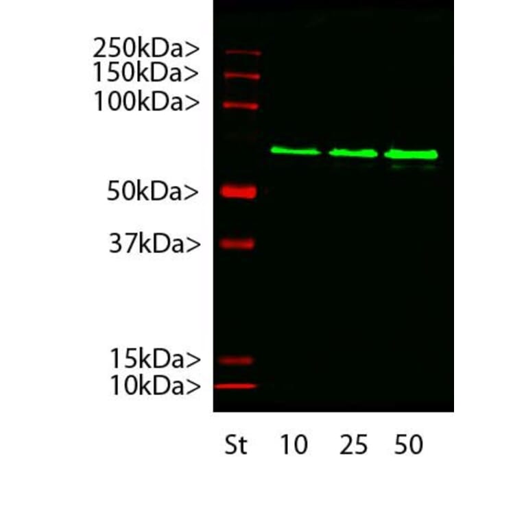 Western Blot - Anti-alpha Internexin Antibody [2E3] (A85448) - Antibodies.com