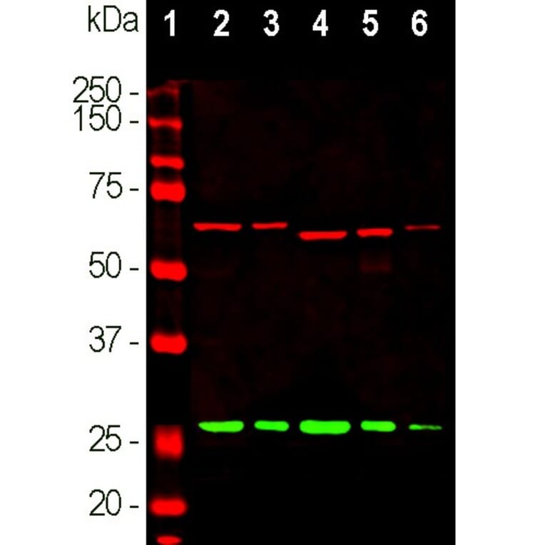 Western Blot - Anti-alpha Internexin Antibody [2E3] (A85448) - Antibodies.com