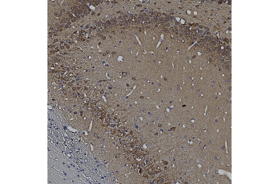 Immunohistochemistry - Anti-Ubiquilin 2 Antibody [6H9] (A85449) - Antibodies.com