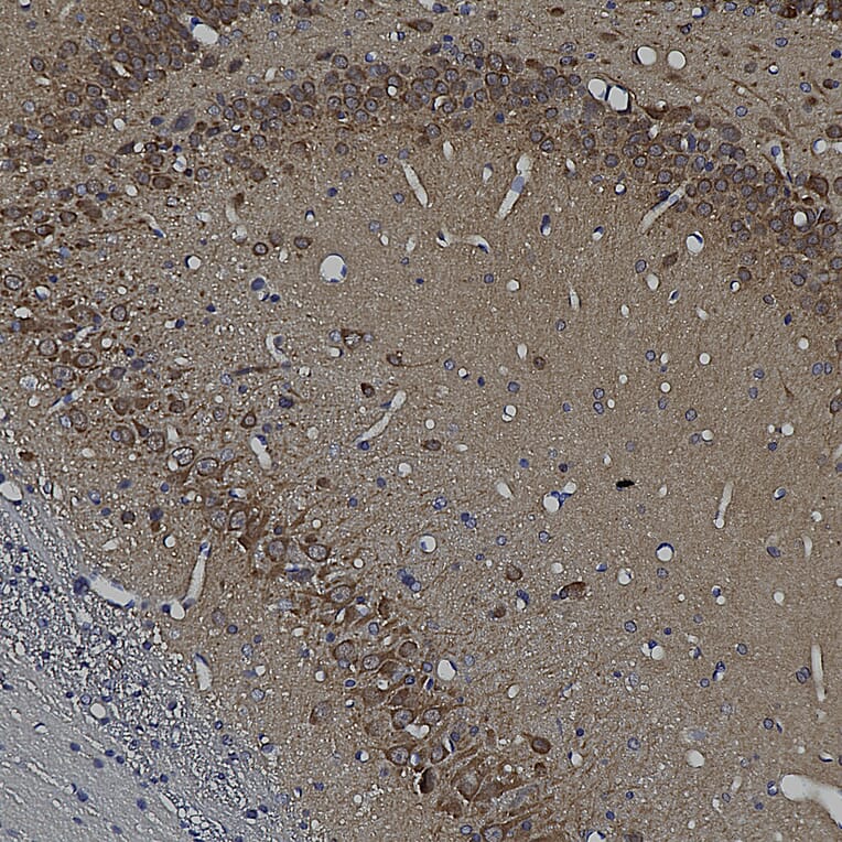 Immunohistochemistry - Anti-Ubiquilin 2 Antibody [6H9] (A85449) - Antibodies.com