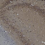 Immunohistochemistry - Anti-Ubiquilin 2 Antibody [6H9] (A85449) - Antibodies.com