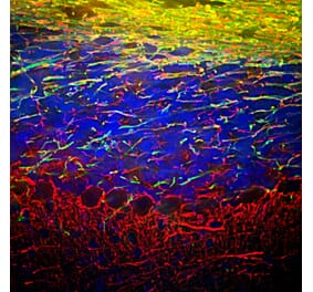 Immunofluorescence - Anti-NF-L Antibody (A85451) - Antibodies.com