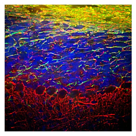 Immunofluorescence - Anti-NF-L Antibody (A85451) - Antibodies.com