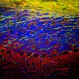 Immunofluorescence - Anti-NF-L Antibody (A85451) - Antibodies.com