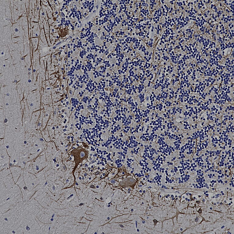 Immunohistochemistry - Anti-NF-L Antibody (A85451) - Antibodies.com