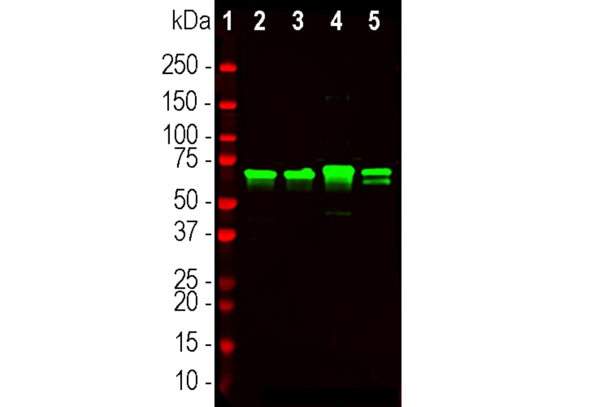 Western Blot - Anti-NF-L Antibody (A85451) - Antibodies.com
