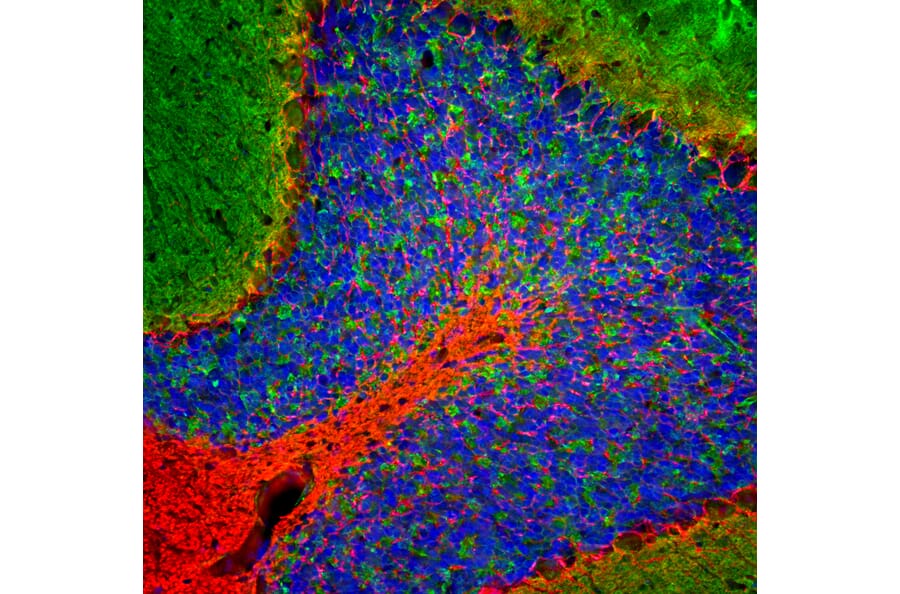 Immunofluorescence - Anti-NF-L Antibody (A85451) - Antibodies.com