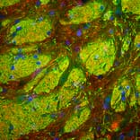 Immunofluorescence - Anti-NF-L Antibody (A85451) - Antibodies.com