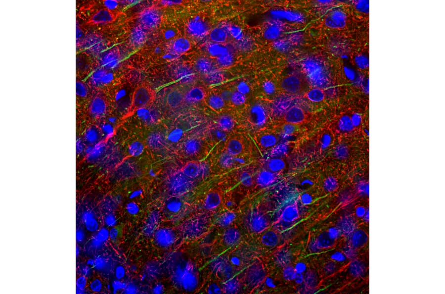 Immunofluorescence - Anti-NF-L Antibody (A85451) - Antibodies.com