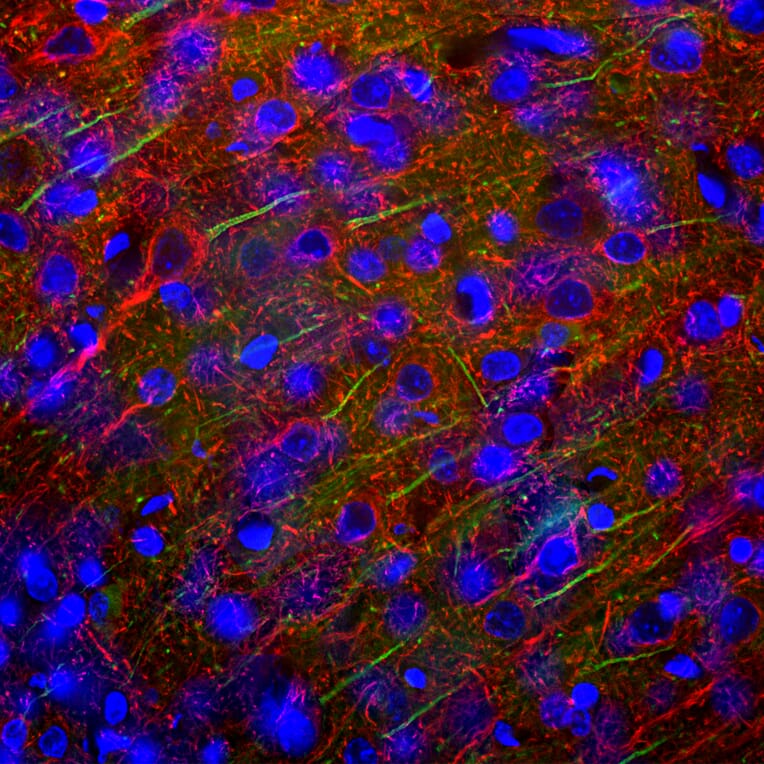Immunofluorescence - Anti-NF-L Antibody (A85451) - Antibodies.com