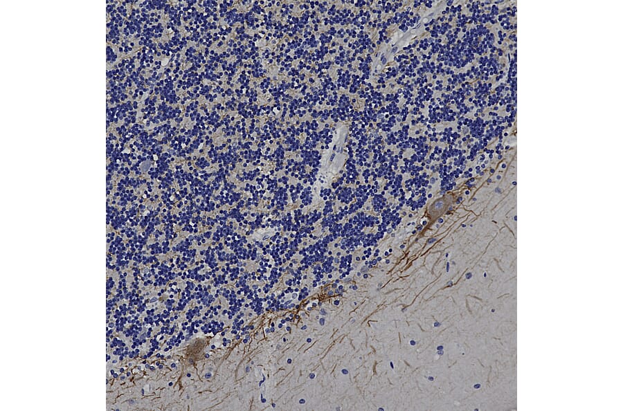 Immunohistochemistry - Anti-NF-L Antibody (A85451) - Antibodies.com