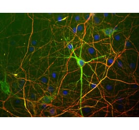 Immunofluorescence - Anti-NF-L Antibody [7D1] (A85453) - Antibodies.com