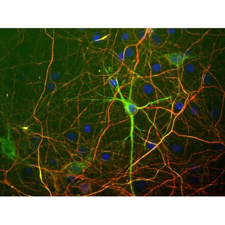 Immunofluorescence - Anti-NF-L Antibody [7D1] (A85453) - Antibodies.com
