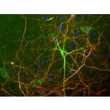 Immunofluorescence - Anti-NF-L Antibody [7D1] (A85453) - Antibodies.com