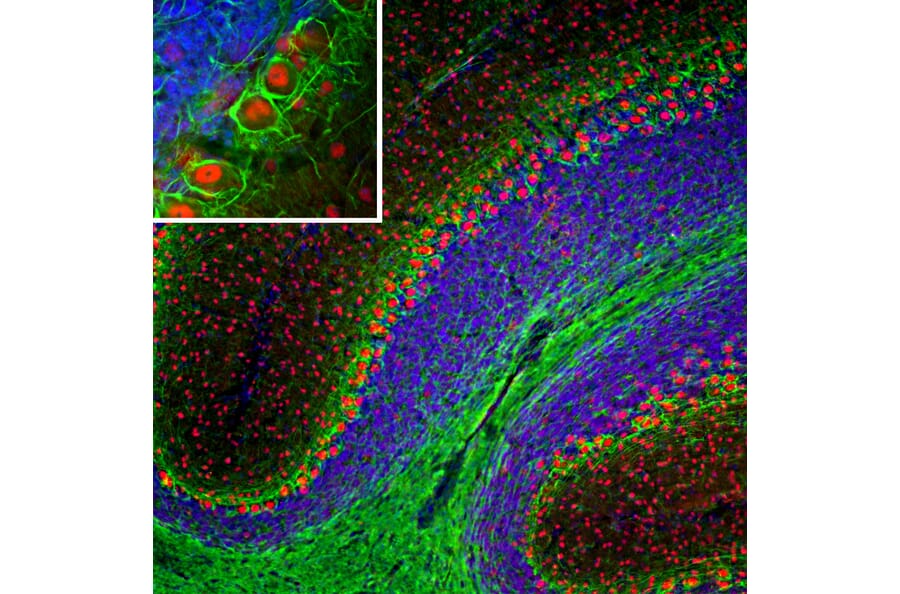 Immunofluorescence - Anti-NF-L Antibody [7D1] (A85453) - Antibodies.com