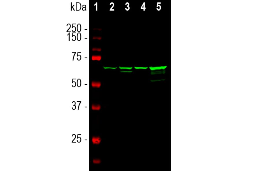 Western Blot - Anti-NF-L Antibody [7D1] (A85453) - Antibodies.com