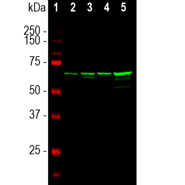 Western Blot - Anti-NF-L Antibody [7D1] (A85453) - Antibodies.com