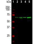 Western Blot - Anti-NF-L Antibody [7D1] (A85453) - Antibodies.com