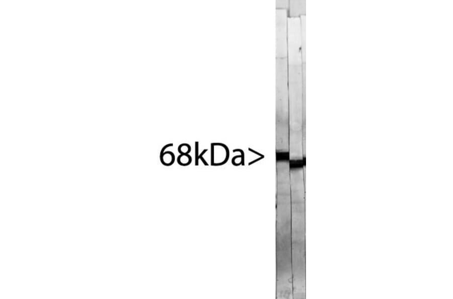 Western Blot - Anti-NF-L Antibody [7D1] (A85453) - Antibodies.com