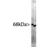 Western Blot - Anti-NF-L Antibody [7D1] (A85453) - Antibodies.com