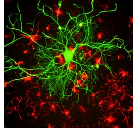 Immunofluorescence - Anti-NF-L Antibody [DA2] (A85454) - Antibodies.com
