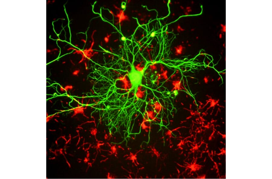 Immunofluorescence - Anti-NF-L Antibody [DA2] (A85454) - Antibodies.com