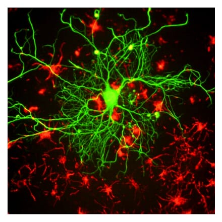 Immunofluorescence - Anti-NF-L Antibody [DA2] (A85454) - Antibodies.com