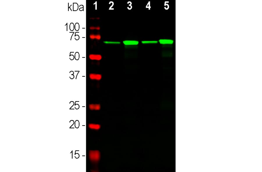 Western Blot - Anti-NF-L Antibody [DA2] (A85454) - Antibodies.com