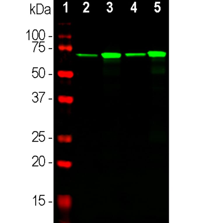 Western Blot - Anti-NF-L Antibody [DA2] (A85454) - Antibodies.com