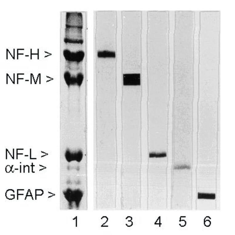 Western Blot - Anti-NF-L Antibody [DA2] (A85454) - Antibodies.com