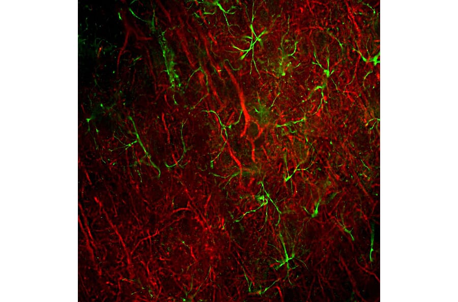 Immunofluorescence - Anti-NF-L Antibody [DA2] (A85454) - Antibodies.com