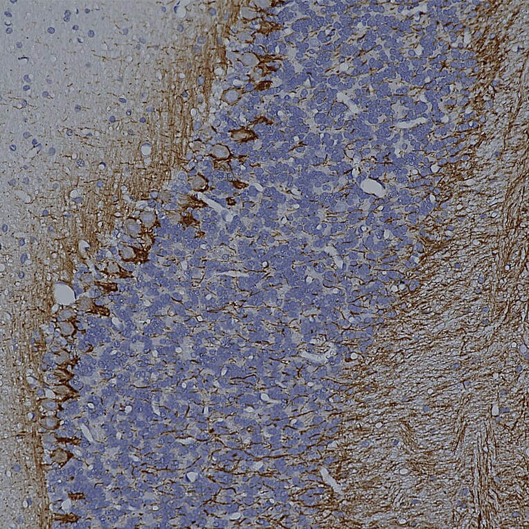 Immunohistochemistry - Anti-NF-L Antibody [DA2] (A85454) - Antibodies.com