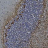 Immunohistochemistry - Anti-NF-L Antibody [DA2] (A85454) - Antibodies.com