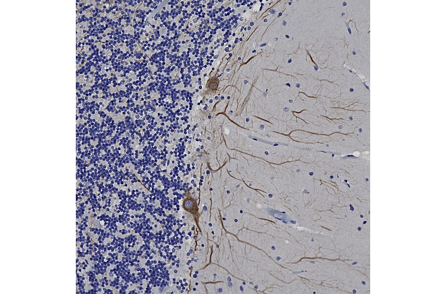 Immunohistochemistry - Anti-NF-L Antibody [DA2] (A85454) - Antibodies.com