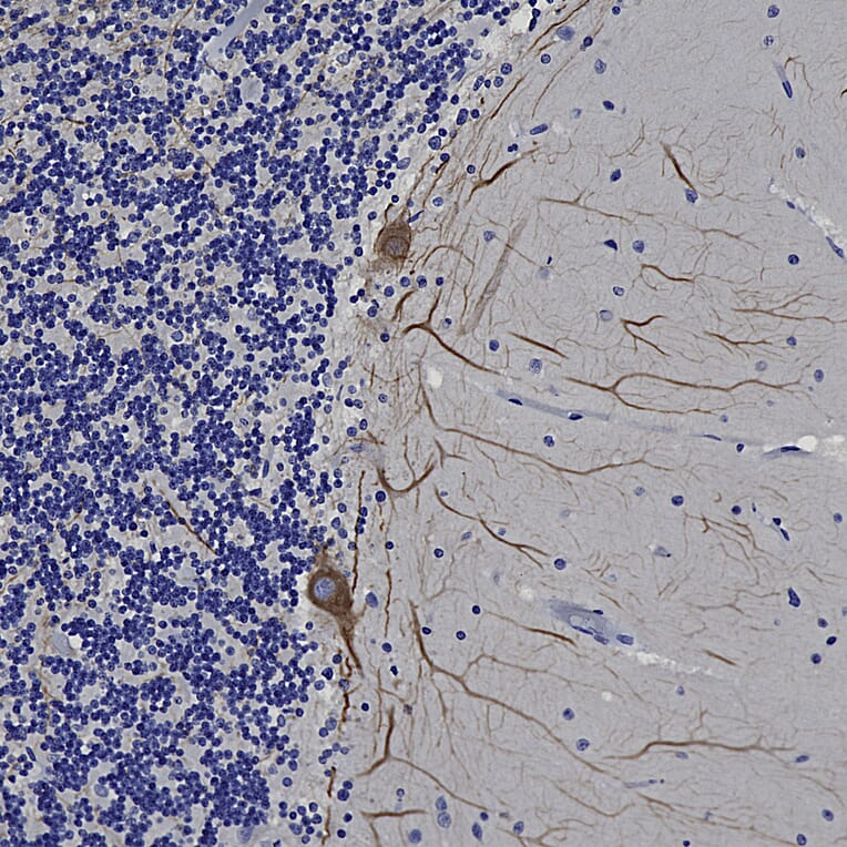 Immunohistochemistry - Anti-NF-L Antibody [DA2] (A85454) - Antibodies.com