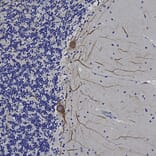 Immunohistochemistry - Anti-NF-L Antibody [DA2] (A85454) - Antibodies.com